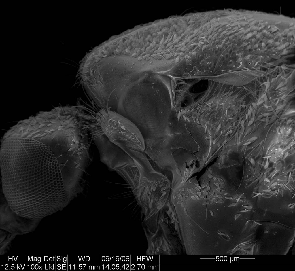 Scanning electron micrograph of a mosquito thorax showing the spiracle region